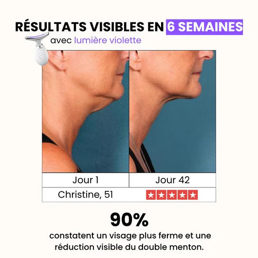 Auralift™ – Technologie de Soin LED 7-en-1 pour une Peau Liftée et Éclatante